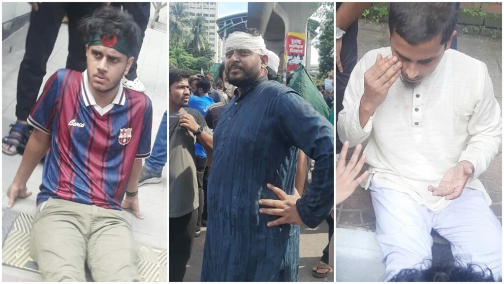 পুলিশ ও প্রকৌশল শিক্ষার্থীদের ধাওয়া-পাল্টা ধাওয়া, আহত ৫ জন ঢামেকে