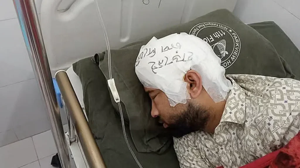 ‘হাড় নেই, চাপ দেবেন না’ চবি শিক্ষার্থীর মাথায় সতর্কবার্তা ‘হাড় নেই, চাপ দেবেন না’ চবি শিক্ষার্থীর মাথায় সতর্কবার্তা
