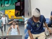 রূপগঞ্জে গ্রিন ইউনিভার্সিটির বাসে হামলা, রক্তাক্ত শিক্ষার্থী ও স্টাফ