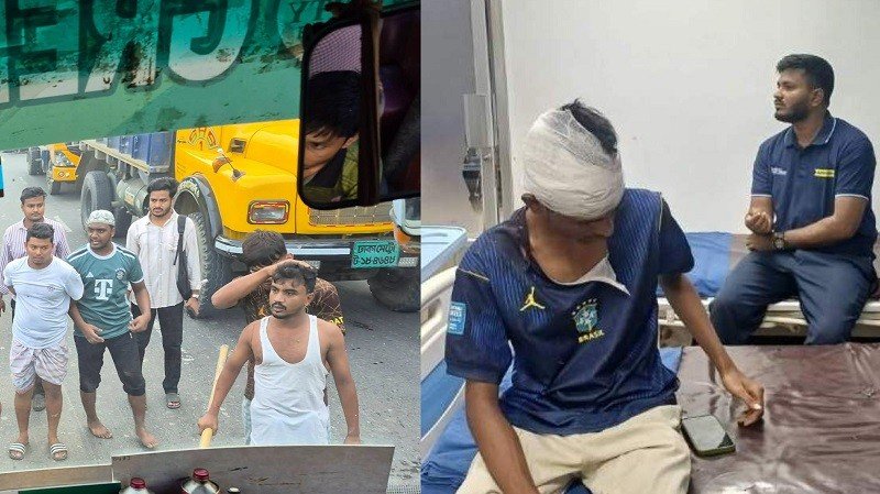 রূপগঞ্জে গ্রিন ইউনিভার্সিটির বাসে হামলা, রক্তাক্ত শিক্ষার্থী ও স্টাফ