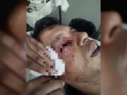 ট্রেনে পাথর নিক্ষেপ, চোখ হারালেন আইনজীবী