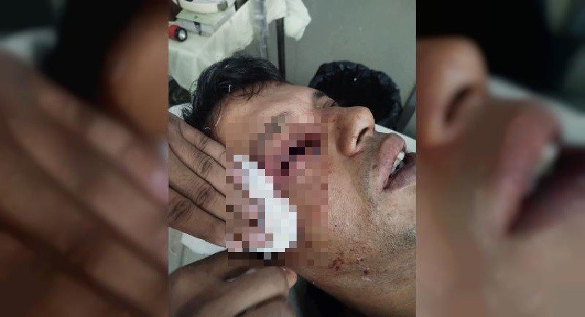 ট্রেনে পাথর নিক্ষেপ, চোখ হারালেন আইনজীবী