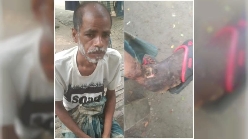 অর্থাভাবে চিকিৎসা করাতে পারছেন না যশোর চৌগাছার ভ্যানচালক