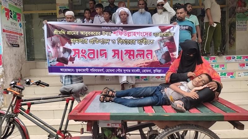কুমিল্লায় ৯ বছরের শিশুর উপর অমানুষিক নির্যাতন