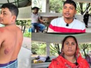 বুড়িচংয়ে প্রবাসী যুবককে বাড়ি থেকে ডেকে নিয়ে বেধড়ক মারধর; বিচার চাইলেন মা