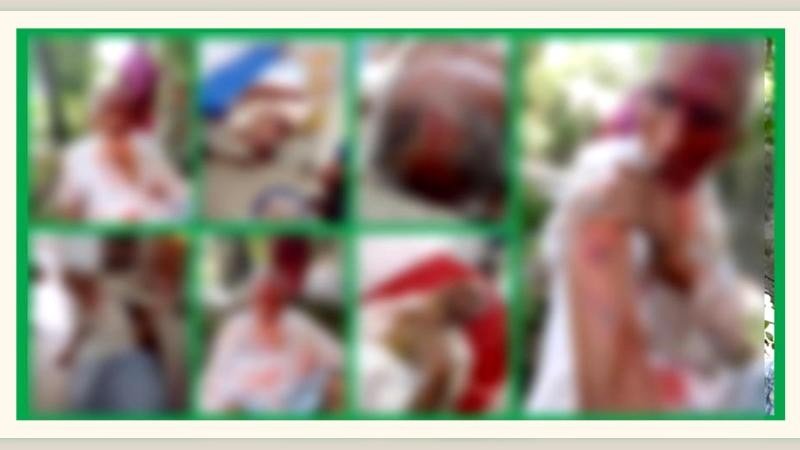 বরিশালে চাঁদাবাজির মামলায় জামিনে বের হয়ে বাদীসহ তিনজনকে কুপিয়ে জখম