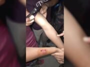 গাঁজাসেবীর কামড়ে ২ যুবক আহত, ১৫ ফুট উচ্চতার গাঁজা গাছসহ আটক ১