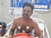 সাপের কামড় খেয়ে নিজেই হাসপাতালে চিকিৎসা নিচ্ছেন ‘বিষঝাড়া ওঝা’