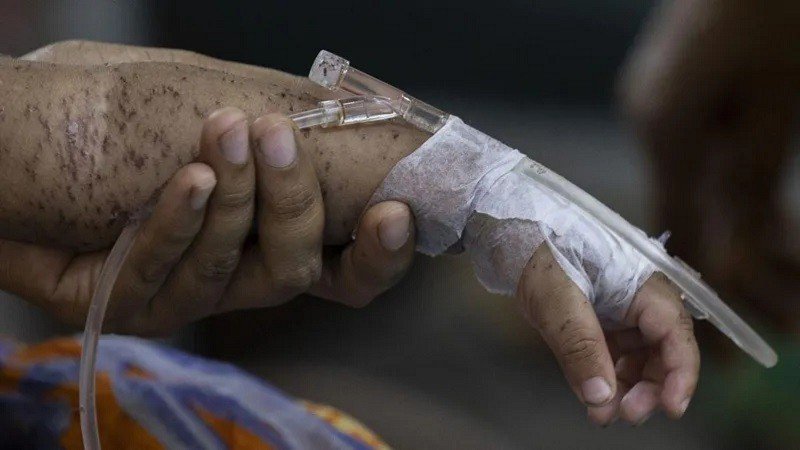 হামের উপসর্গ নিয়ে আরও ৭ শিশুর মৃত্যু