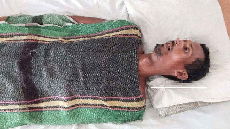 নড়াইলে চোর সন্দেহে নির্যাতনের শিকার প্রতিবন্ধী যুবকের মৃত্যু