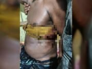 তাহিরপুরে পূর্ববিরোধের জেরে ৬ জনকে কুপিয়ে আহত, ২ জন আইসিইউতে