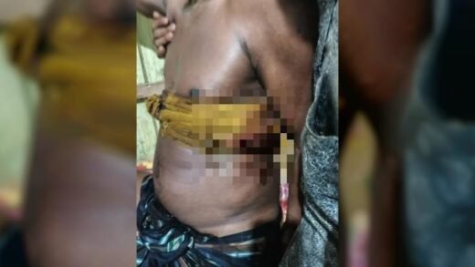 তাহিরপুরে পূর্ববিরোধের জেরে ৬ জনকে কুপিয়ে আহত, ২ জন আইসিইউতে