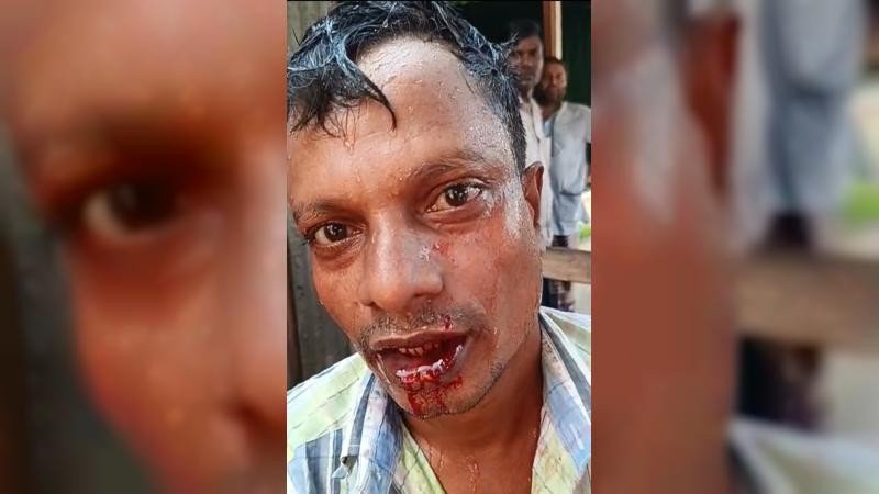 ভূরুঙ্গামারীতে মাদকবিরোধী কর্মসূচিতে হামলা, আহত ১
