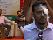 চোখে ব্যান্ডেজ নাসীরুদ্দীন পাটওয়ারীর, কী হয়েছে?