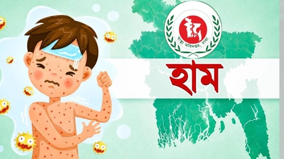 হাম উপসর্গে আরও ৪ শিশুর মৃত্যু, মোট প্রাণহানি ৮৯৪