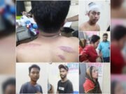 দিনেদুপুরে ভাড়াটিয়া সন্ত্রাসী নিয়ে মিরিঞ্জা রয়েল হিল রিসোর্টে হামলা, আহত ৯