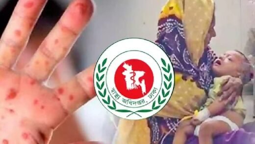 হামের উপসর্গে আরও ৬ শিশুর মৃত্যু