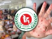 দেশে হামে মৃত্যু ১ হাজার ৪৮, নতুন শনাক্ত ৫২ জন