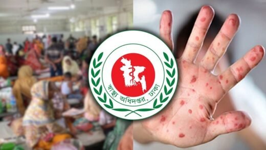 হাম উপসর্গে আরো দুই শিশুর মৃত্যু
