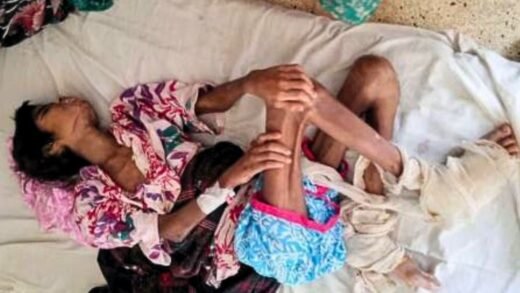 শিক্ষিকার বাসায় নির্যাতন, ক্ষত-ছ্যাঁকার দাগে কাতর শিশু তানিয়া
