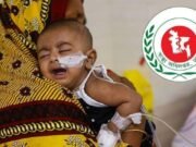 দেশে হাম উপসর্গ নিয়ে আরও ২ শিশুর মৃত্যু