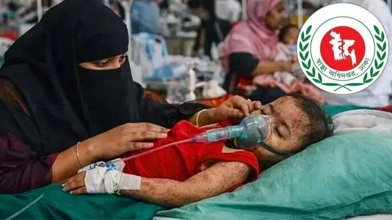 ২৪ ঘণ্টায় হামের উপসর্গে আরও ৫ মৃত্যু